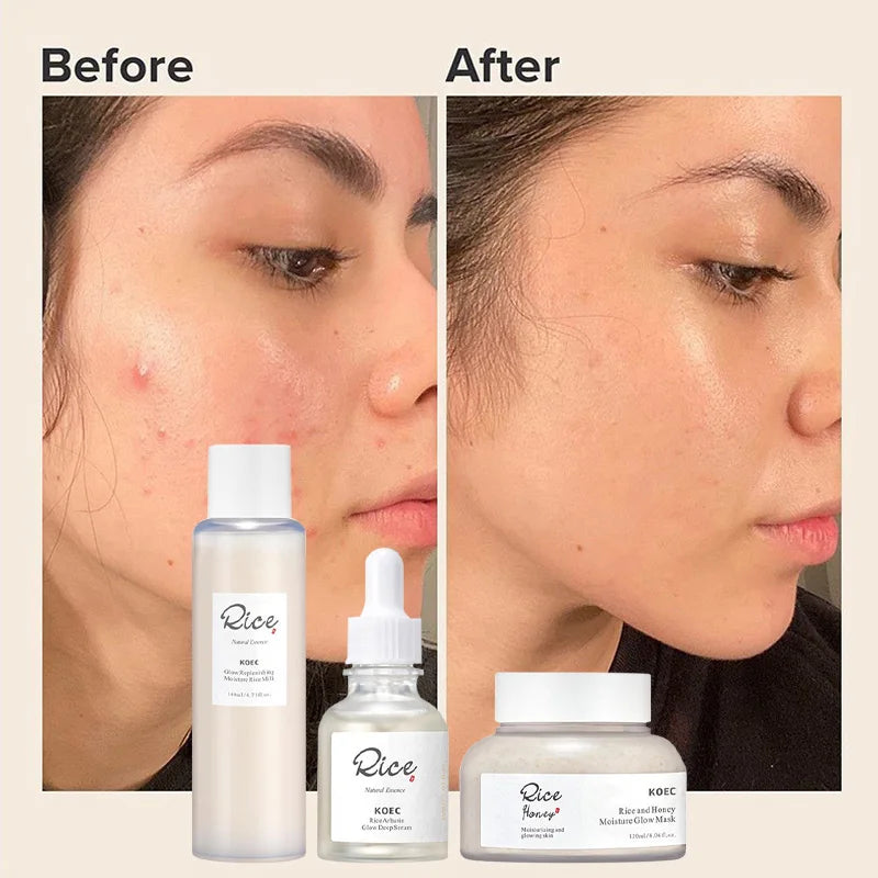Korean Rice & Honey Skincare Set – Brightening & Firming for Women