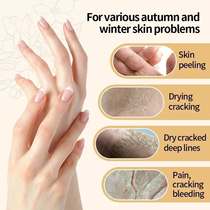 Kojic Acid Hand Cream – Brightening & Anti-Aging