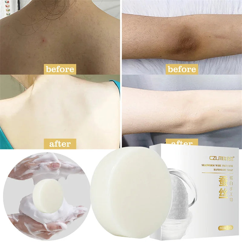 Body Whitening Silk Soap – Brightening & Moisturizing